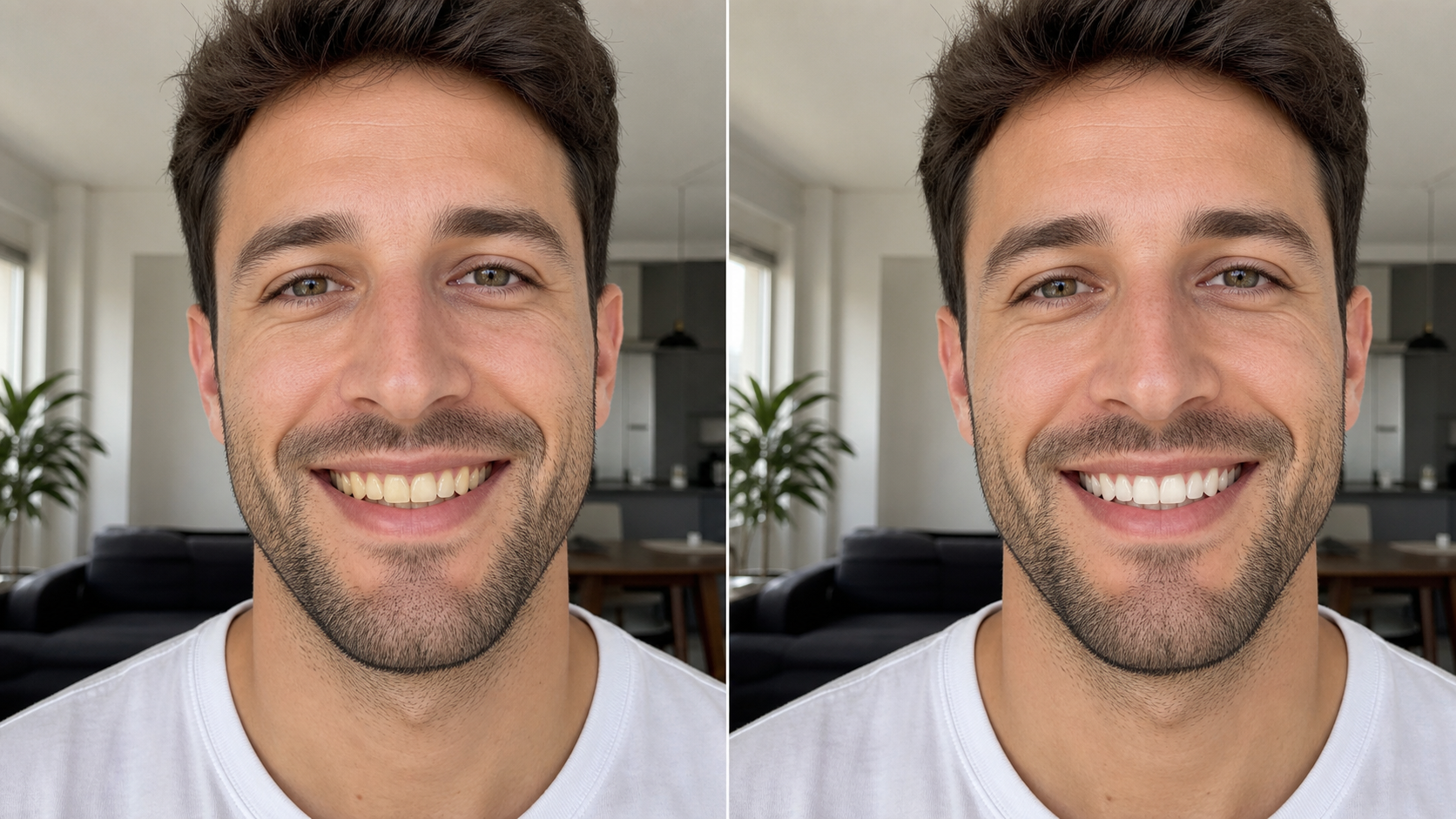 Natural Teeth Whitening AI Without Fake White