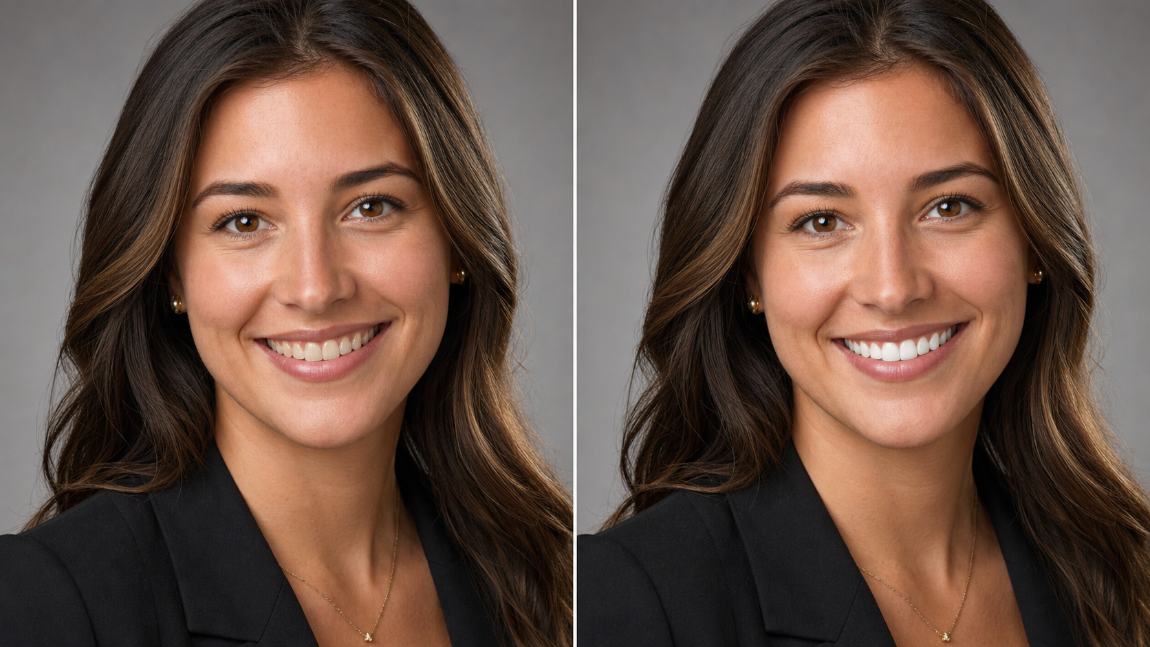AI Teeth Whitening That Protects the Rest of the Face
